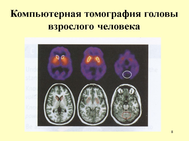 8 Компьютерная томография головы взрослого человека